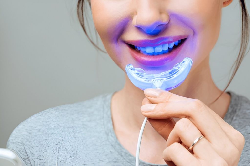 teeth whitening in bridgeland ab