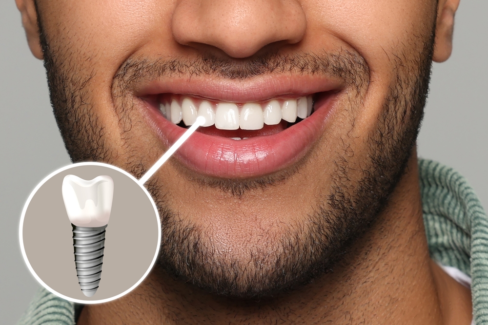 are dental implants safe for seniors benefits & risks