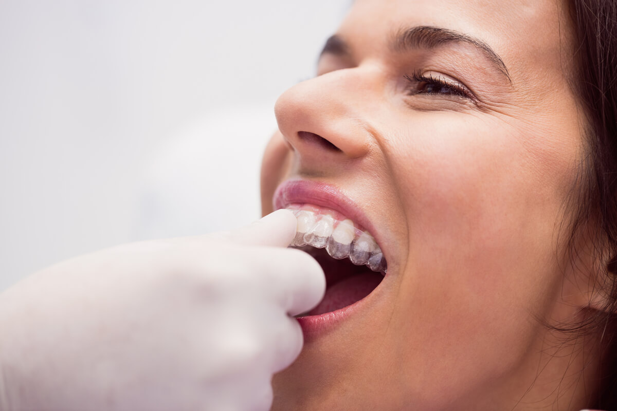 invisalign in 2026 what’s new & why it’s so popular