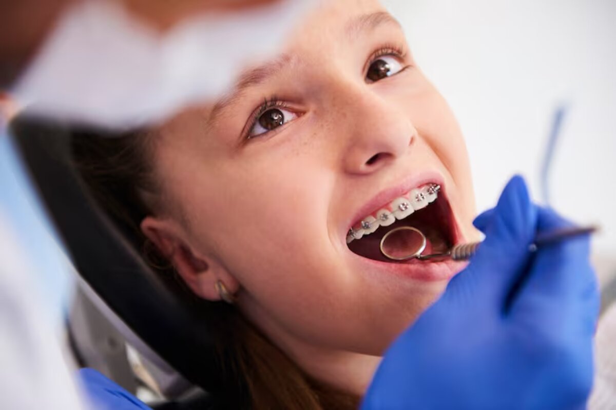 periodontal treatment